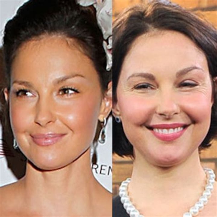 Ashley Judd face accident 1 Ashley Judd face accident Why was Ashley Judds face swollen