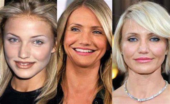 Cameron Diaz Plastic Surgery Before and After