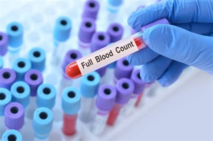 Could a Blood Test Effectively Screen for Cancers?