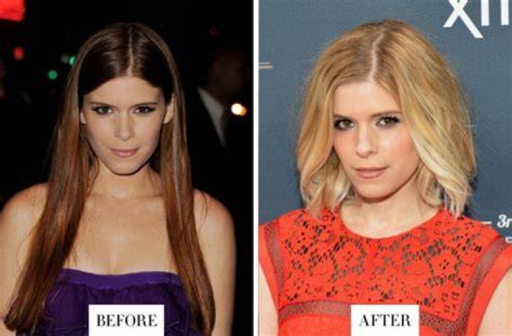 Kate Mara Plastic Surgery Before and After