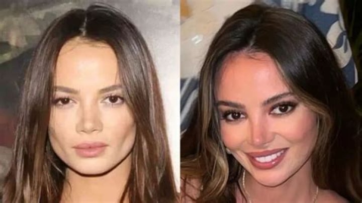 Keleigh Teller’s Plastic Surgery: Keleigh's Transformed Appearance vs. Potential Procedures!
