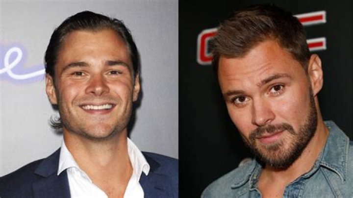 Patrick Flueger plastic surgery
